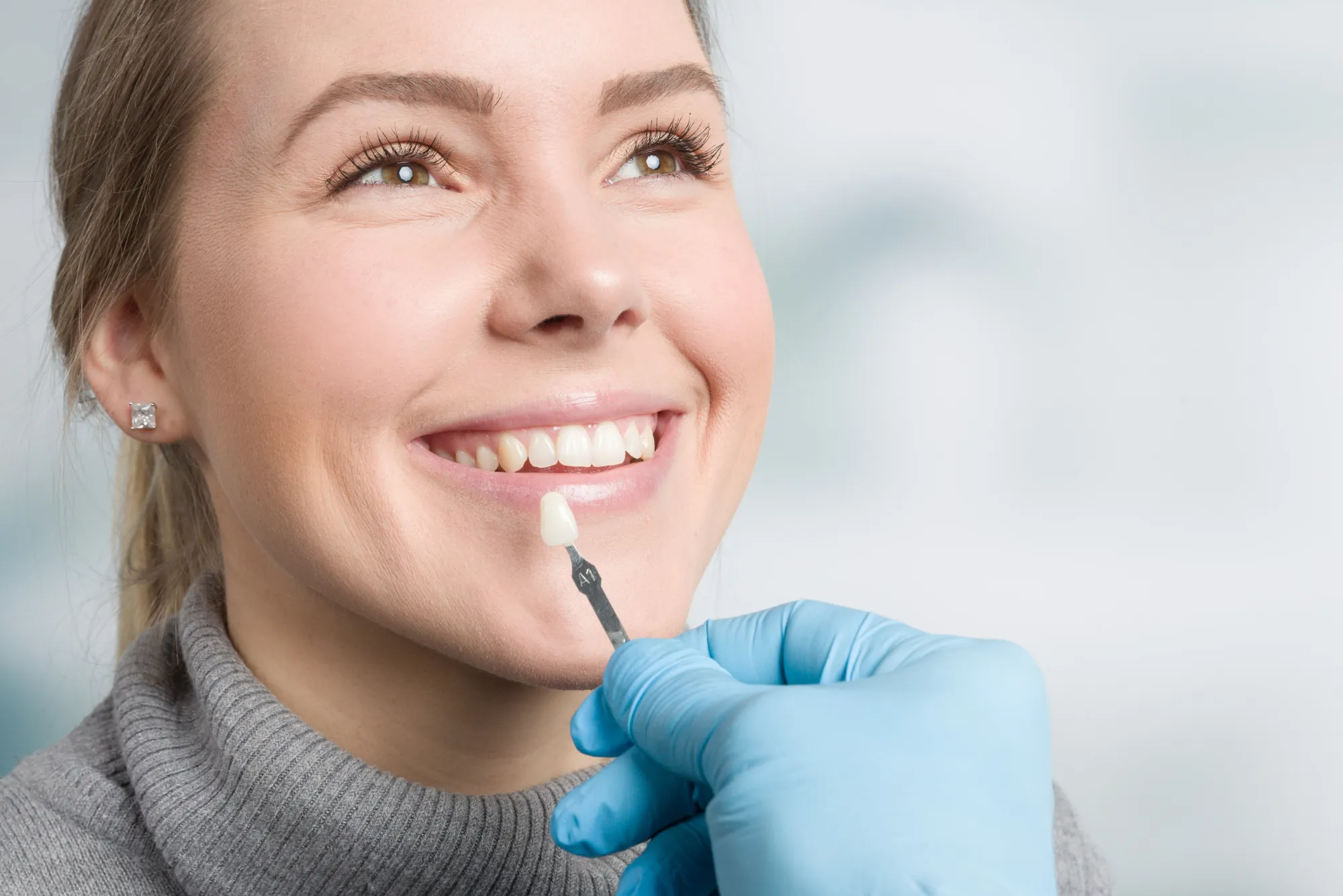 What are the Best Places for Veneers in Dubai