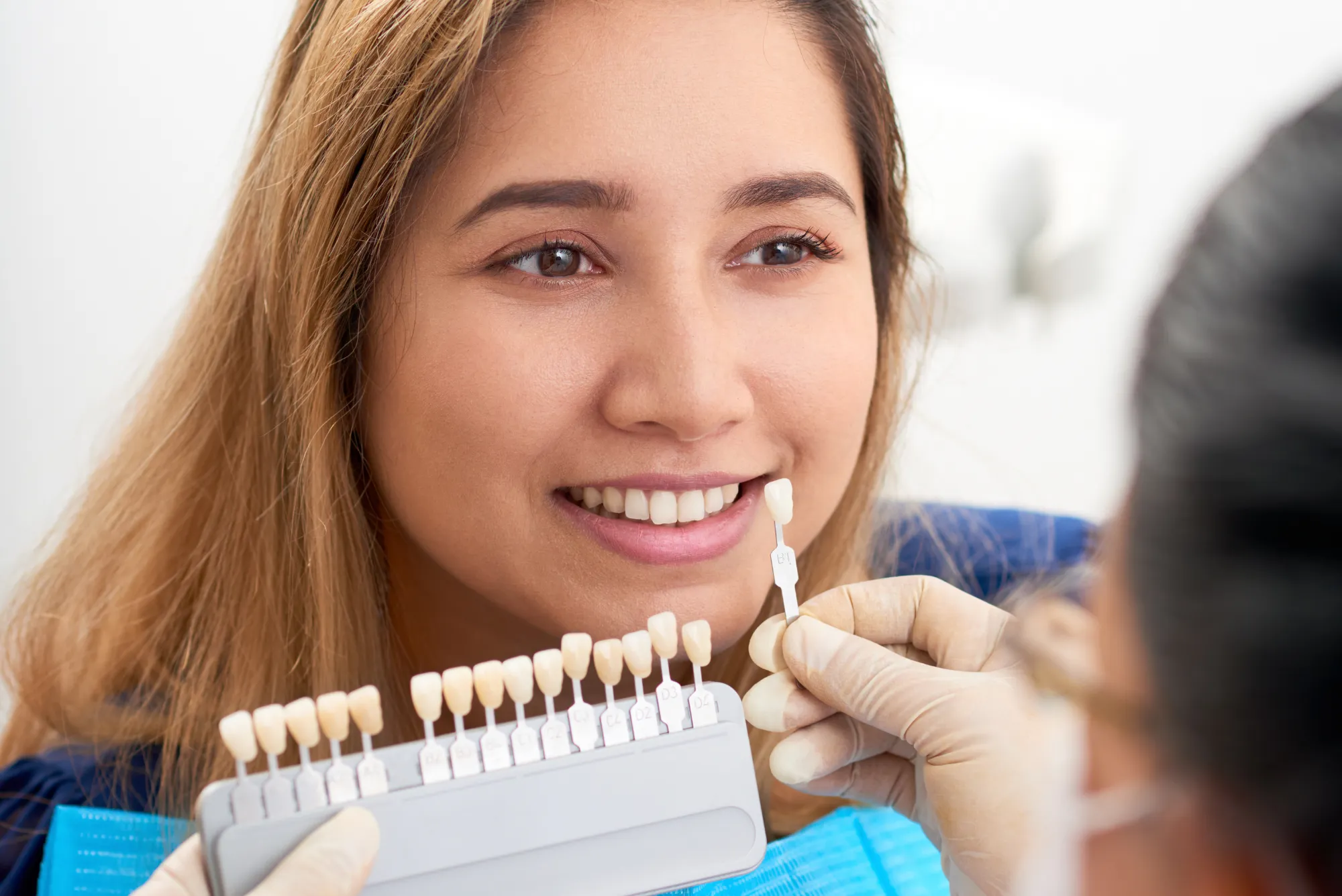 the Best Places for Veneers in Dubai