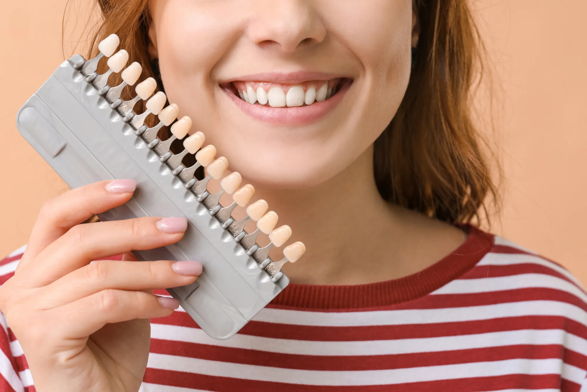 are the Best Places for Veneers in Dubai